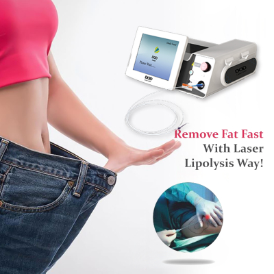 Lipolysis