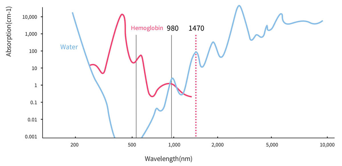 Principle of 980nm-1470nm-laser-diode