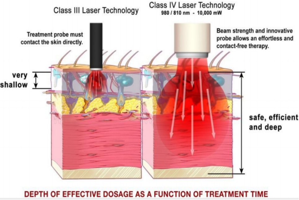 laser comparative degree